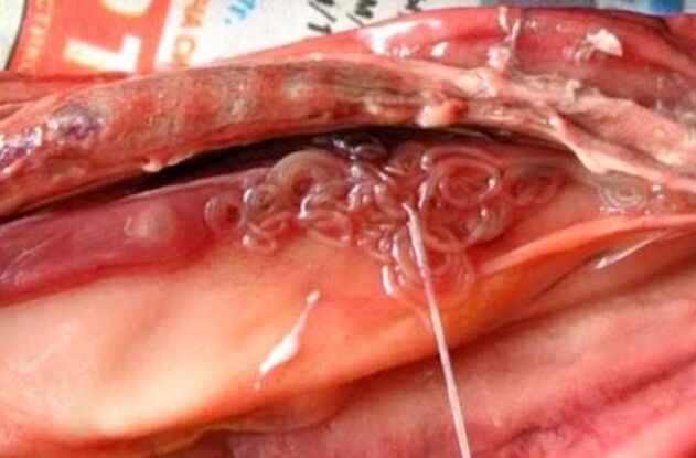 blow to the gall bladder