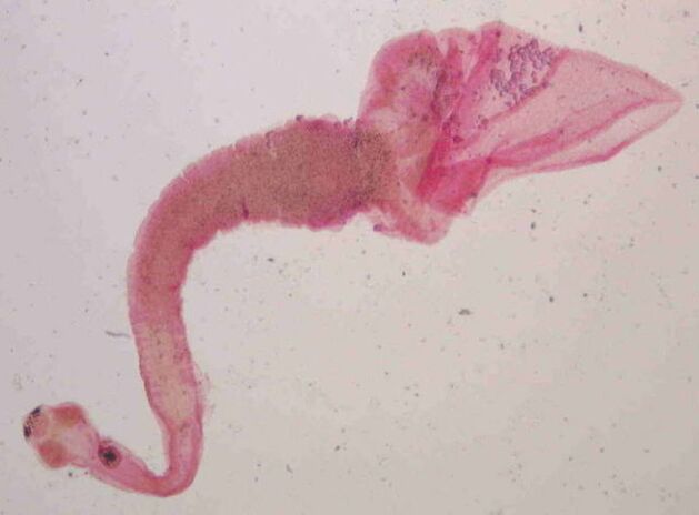 pork strip from people