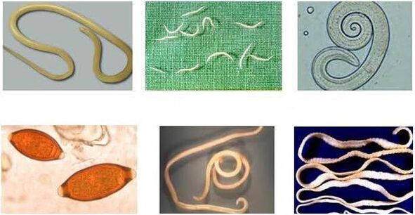 Worms that can infect the human body
