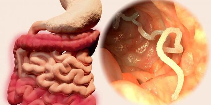 the worm is a parasite in humans