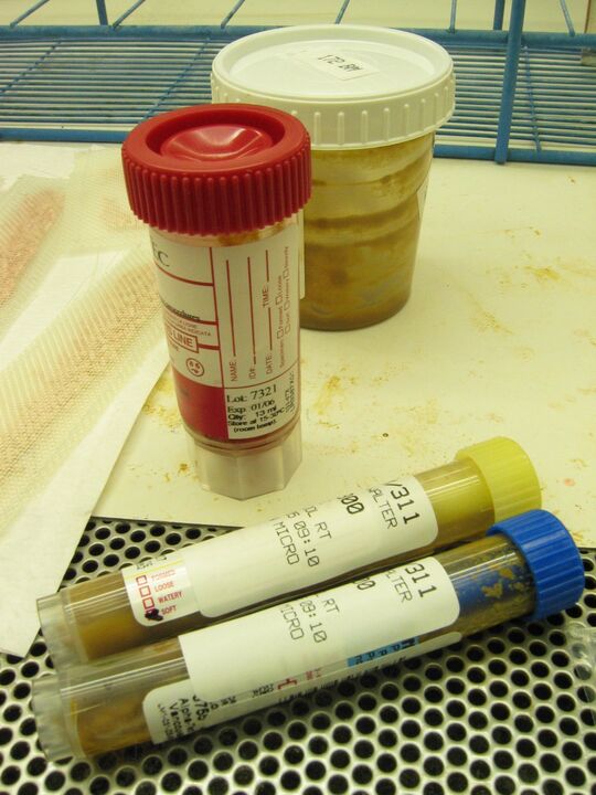 parasite detection tests